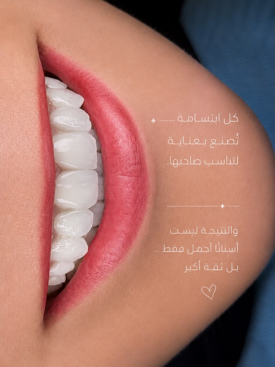 ابتسامة تُصنع بعناية