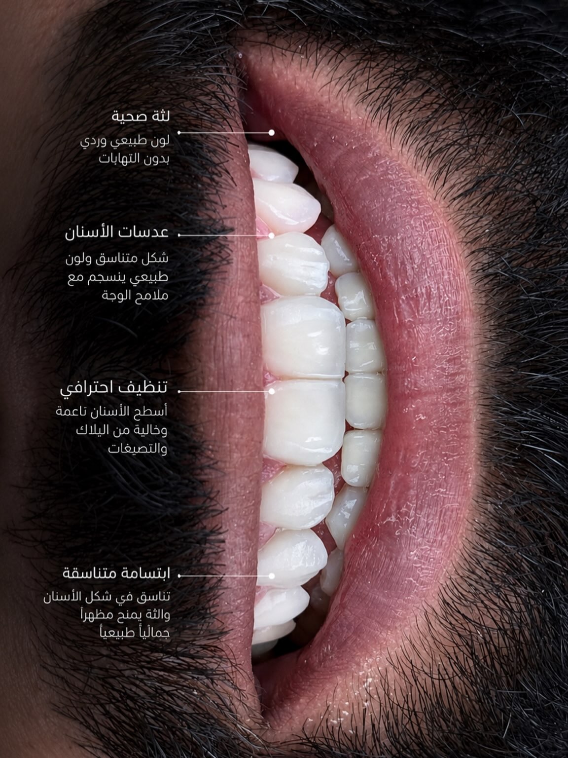 تفاصيل ابتسامة متناسقة وعناية باللثة