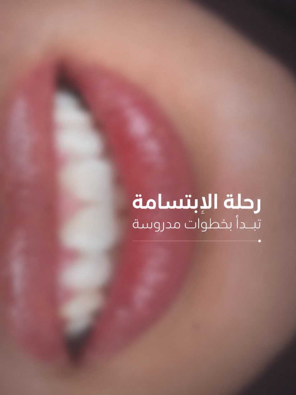 رحلة الابتسامة